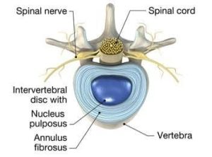 intervertebral-disc